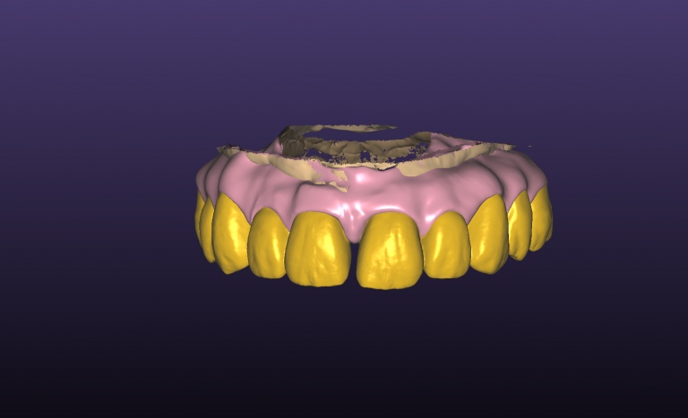 teeth5