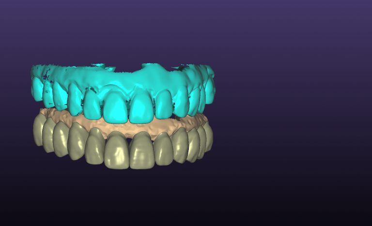 teeth7